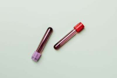 Hematologija