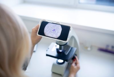 Close up of a test galss with sample for cytological analysis